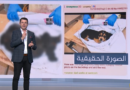Fake pictures of Israeli allegations of killing Israeli children